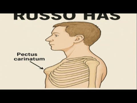 I Have A Gh Bone Growth Bump (pectus Carinatum) On Chest From Mk 677 Abuse Primarily But Gh Pathway