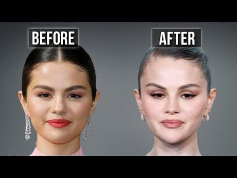 Selena Gomez’s Plastic Surgery Tells A Story… And It’s Not What You Think ​