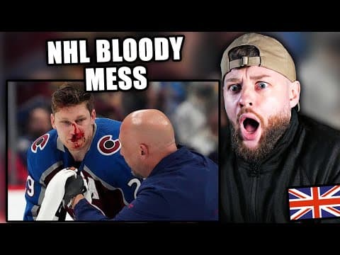 Soccer Fan Shocked At "nhl Bloody Mess"