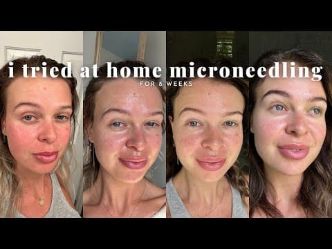 At Home Microbneeding | 8 Weeks