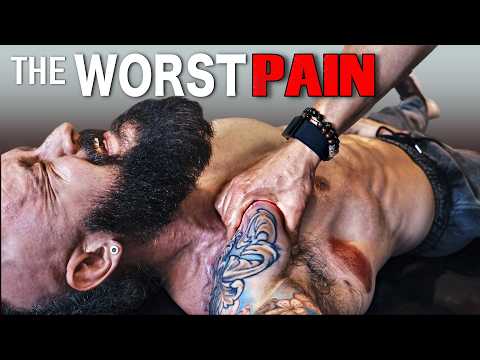 The Worst Pain: Chronic Shoulder Pain & Mobility Fixed | Removing Huge Muscle Knots & No Surgery