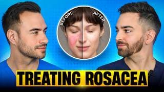 Treat Rosacea Like A Dermatologist