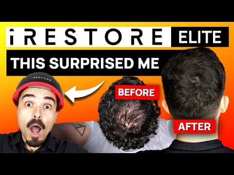 Irestore Elite Review: 5 Things To Know For Hair Loss Treatment