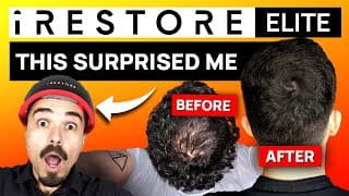 Irestore Elite Review: 5 Things To Know For Hair Loss Treatment