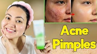 Oil Control & Acne Care | Best Face Wash For Pimples That Actually Works