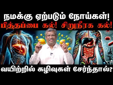 Gallstones! Kidney Stones! | Body Detox | 3 Days Challenge! | Stop Wasting Time!! | Healer Baskar