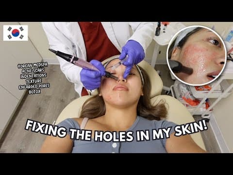 Non-invasive Treatment To Remove Acne Skin Texture! *only Trusting Korean Aesthetics Bc It Works*