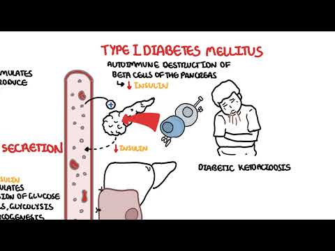 Type I And Type Ii Diabetes, Chronic Complications And Management