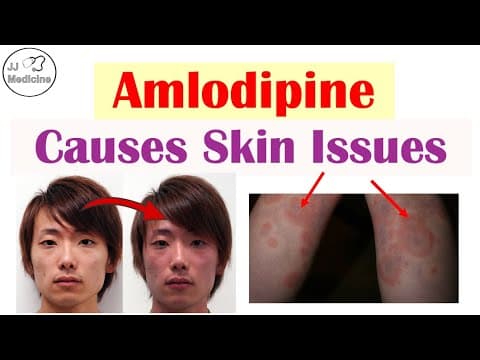 These 4 Skin Disorders Can Be Caused By Amlodipine (most You've Probably Never Heard Of)