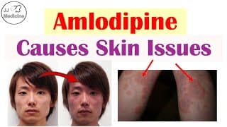These 4 Skin Disorders Can Be Caused By Amlodipine (most You've Probably Never Heard Of)
