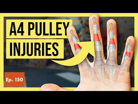 A4 Pulley Injuries In Rock Climbers (causes, Risks, & Full Recovery)