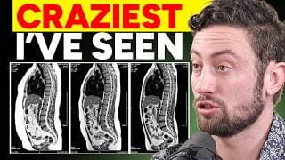 Fat Loss Doctor Reveals Most Powerful Fat Burners That Legally Exist - Dr. Kyle Gillett