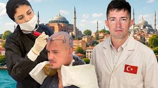 Surprising A Stranger With A Free Hair Transplant In Istanbul
