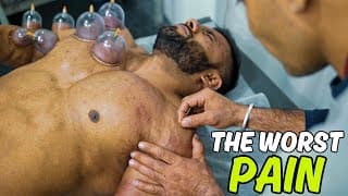 Dry Needling, Graston & Cupping Therapy For Flexibility & Muscle Recovery|| Benifits Of Therapy