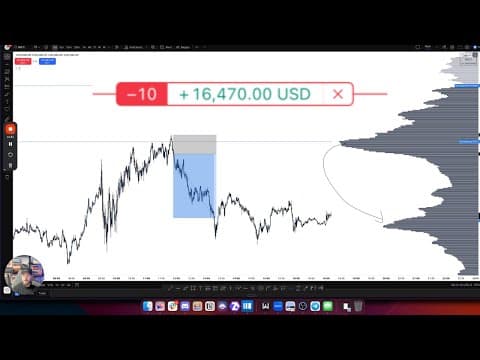 Watch Me Day Trade Live Using Volume Profile (i Sized Up)