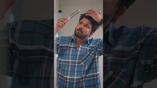 Dandruff Problems In Men 🥲