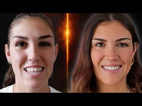 Double Jaw Surgery: 5 Years Later (cost, Recovery, And My Only Regrets)