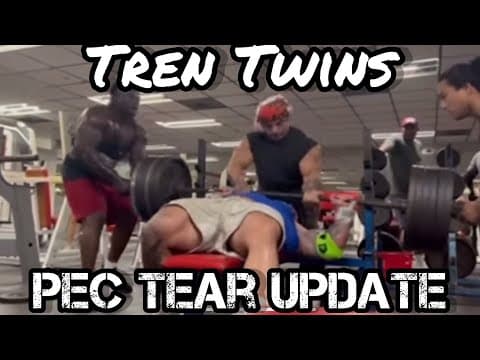 Tren Twins: Mickey’s Torn Pec Good News?