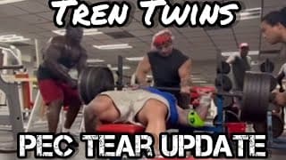 Tren Twins: Mickey’s Torn Pec Good News?